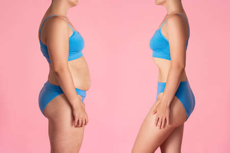 Woman's body before and after weight loss on pink background, plastic surgery conceptの写真素材