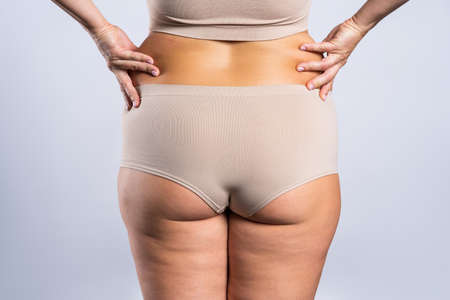 Overweight woman with fat hips and buttocks, obesity female body on gray background, studio shotの写真素材