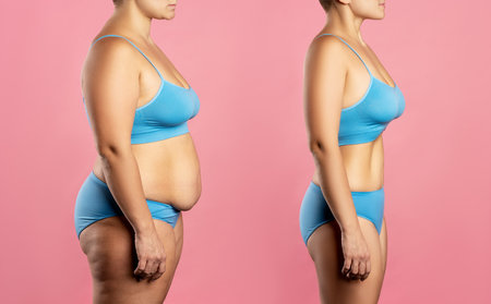 Woman's body before and after weight loss on pink background, plastic surgery conceptの写真素材