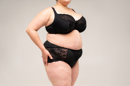 Fat woman in black lingerie, overweight female body on gray background, plastic surgery conceptの写真素材