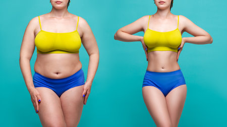 Woman's body before and after weight loss on blue background, plastic surgery conceptの写真素材