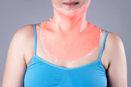 Alginate body mask, neck lifting, beauty treatments for body care on gray backgroundの写真素材