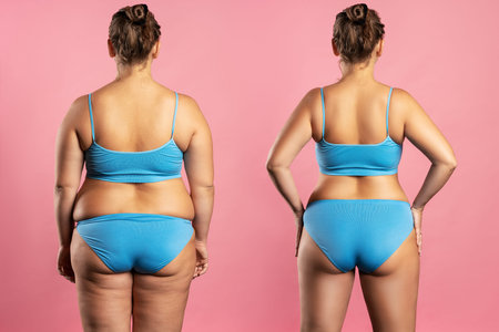 Woman's body before and after weight loss, plastic surgery concept on pink background, studio shot