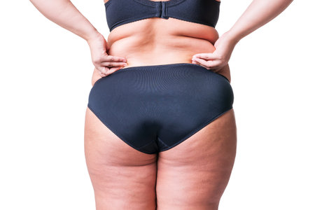 Overweight woman with fat cellulite hips and buttocks, obesity female body isolated on white...