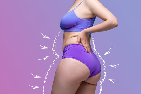 Buttocks, hip, abdomen liposuction, fat and cellulite removal concept, overweight female body with painted surgical lines and arrows on a purple background with a gradientの写真素材