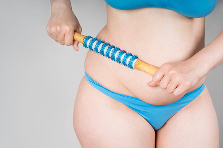 Woman with anti-cellulite roller massager on gray background, body care conceptの写真素材