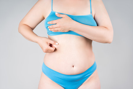 Tummy tuck, flabby skin on a fat belly, plastic surgery concept on gray backgroundの写真素材
