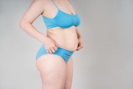 Tummy tuck, flabby skin on a fat belly, plastic surgery concept on gray backgroundの写真素材