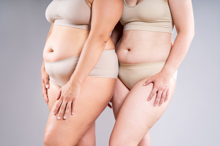 Tummy tuck, two fat women with flabby bellies on gray studio background, plastic surgery and body positive conceptの写真素材