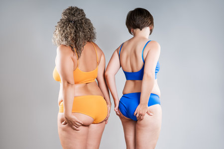 Two overweight women with fat flabby legs, hands, hips and buttocks on gray studio background, plastic surgery and body positive conceptの写真素材
