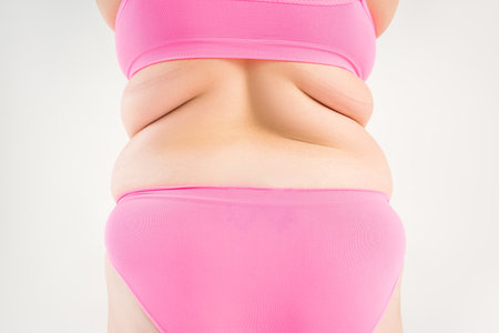 Overweight woman with fat back, folds of skin, obesity female body on gray background, studio shotの写真素材