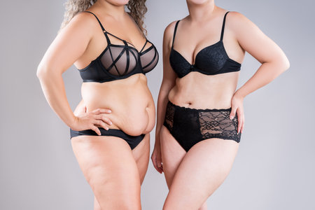 Tummy tuck, two fat women with flabby bellies in black lingerie on gray studio background, plastic surgery and body positive conceptの写真素材