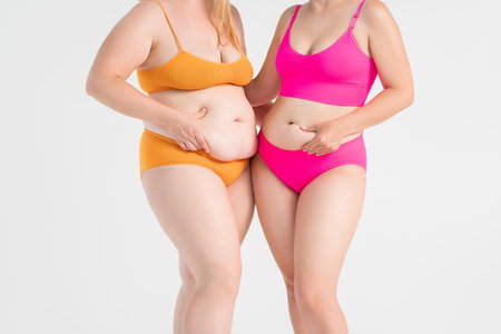 Tummy tuck, two fat women with flabby bellies on gray studio background, plastic surgery and body positive conceptの写真素材