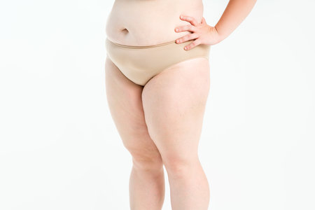 Overweight thigh, woman with fat hips and legs, obesity female body with cellulite on gray studio backgroundの写真素材