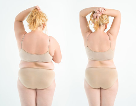 Woman's fat body before and after weight loss, plastic surgery and liposuction concept on light gray studio backgroundの写真素材