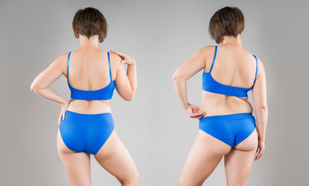 Female body before and after weight loss on gray studio background, woman in black lingerie with perfect buttocks in slimming concept, plastic surgeryの写真素材