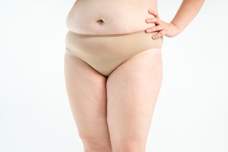 Overweight thigh, woman with fat hips and legs, obesity female body with cellulite on gray studio backgroundの写真素材