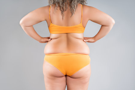 Overweight thigh, woman with fat hips and buttocks, obesity female body with cellulite on gray studio backgroundの写真素材