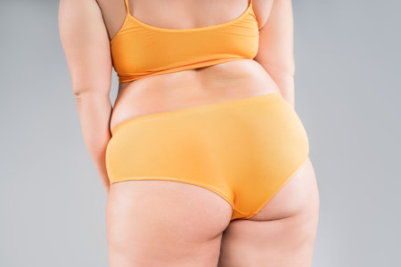 Overweight thigh, woman with fat hips and buttocks, obesity female body with cellulite on gray studio backgroundの写真素材