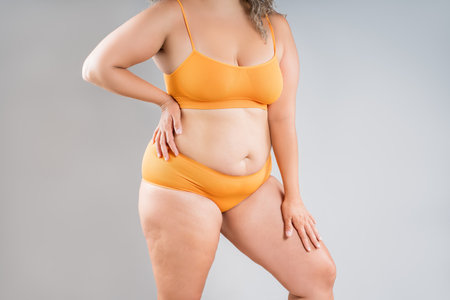 Fat woman in orange underwear on gray studio background, obesity and cellulite, overweight female body, weight loss conceptの写真素材