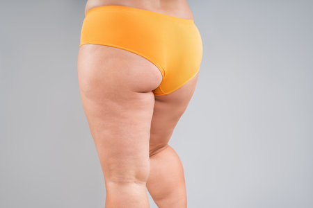 Overweight thighs, woman with fat hips, legs and buttocks, obesity female body with cellulite on gray studio backgroundの写真素材