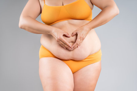 Tummy tuck, flabby skin on a fat belly, abdomen with obesity and cellulite, saggy stomach, plastic surgery concept on gray studio backgroundの写真素材