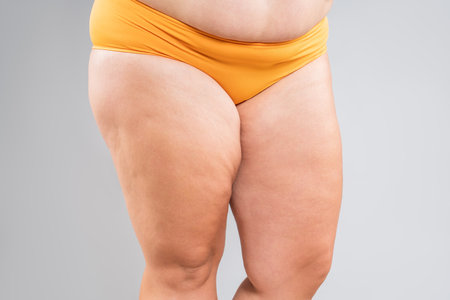 Overweight thighs, woman with fat hips and legs, obesity female body with cellulite on gray studio backgroundの写真素材