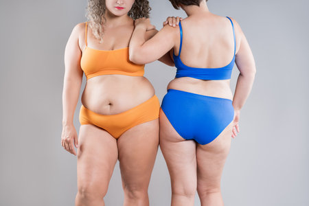 Two overweight women with cellulitis, fat flabby bellies, legs, hands, hips and buttocks on gray studio background, obese female body, liposuction and plastic surgery conceptの写真素材