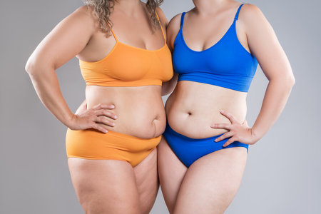 Two overweight women with cellulitis, fat flabby bellies, legs, hands, hips and buttocks on gray studio background, obese female body, liposuction and plastic surgery conceptの写真素材
