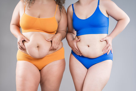 Two overweight women with cellulitis, fat flabby bellies, legs, hips and hands on gray studio background, obese female body, liposuction and plastic surgery conceptの写真素材