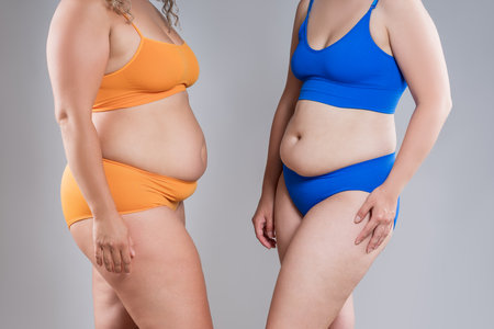 Two overweight women with cellulitis, fat flabby bellies, legs, hands, hips and buttocks on gray studio background, obese female body, liposuction and plastic surgery conceptの写真素材