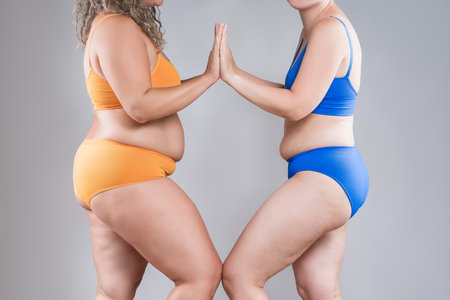 Two overweight women with cellulitis, fat flabby bellies, legs, hands, hips and buttocks on gray studio background, obese female body, liposuction and plastic surgery conceptの写真素材