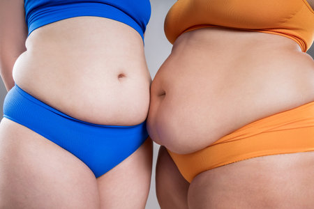 Tummy tuck, two fat women with cellulitis and flabby bellies on gray studio background, obese female body, plastic surgery and liposuction conceptの写真素材