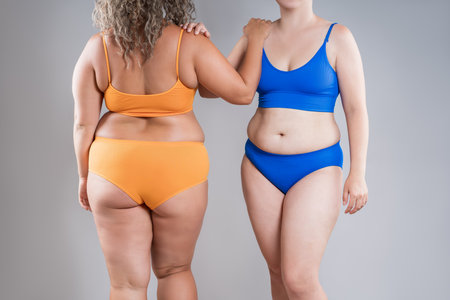 Two overweight women with cellulitis, fat flabby bellies, legs, hands, hips and buttocks on gray studio background, obese female body, liposuction and plastic surgery conceptの写真素材