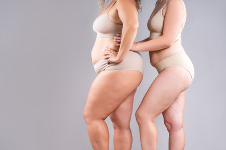Two overweight women with cellulitis, fat flabby bellies, legs, hands, hips and buttocks on gray studio background, obese female body, liposuction and plastic surgery conceptの写真素材