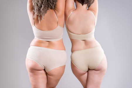 Two overweight women with cellulitis, fat flabby back, hips and buttocks on gray studio background, obese female body, liposuction, plastic surgery and body positive conceptの写真素材