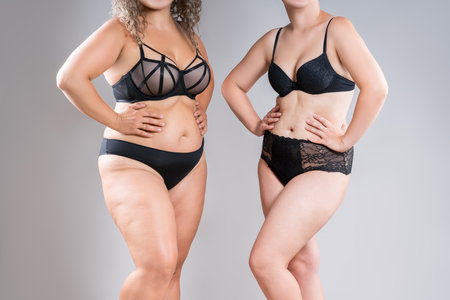 Tummy tuck, two overweight fat women with cellulitis and flabby bellies on gray studio background, obese female body, liposuction and plastic surgery conceptの写真素材