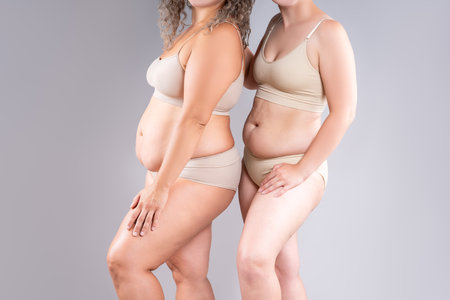 Two overweight women with cellulitis, fat flabby bellies, legs, hands, hips and buttocks on gray studio background, obese female body, liposuction and plastic surgery conceptの写真素材