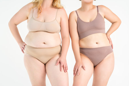 Two overweight women with cellulitis, fat flabby bellies, legs, hands, hips and buttocks on gray studio background, obese female body, liposuction and plastic surgery conceptの写真素材