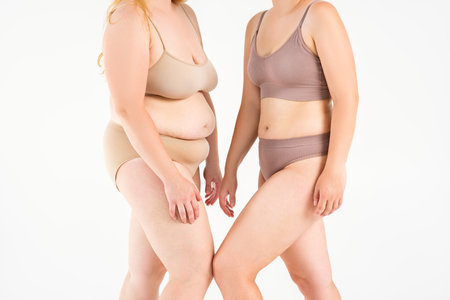 Two overweight women with cellulitis, fat flabby bellies, legs, hands, hips and buttocks on gray studio background, obese female body, liposuction and plastic surgery conceptの写真素材