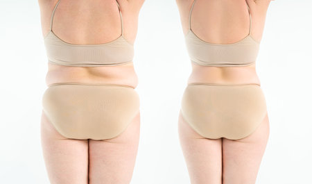 Overweight woman with fat legs and buttocks, before after weight loss concept, obesity female body on gray backgroundの写真素材