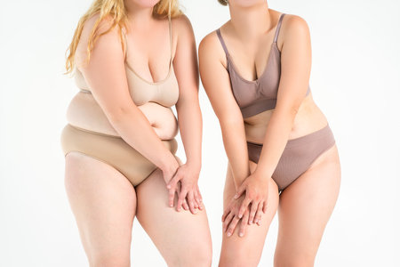 Two overweight women with cellulitis, fat flabby bellies, legs, hands, hips and buttocks on gray studio background, obese female body, liposuction and plastic surgery conceptの写真素材