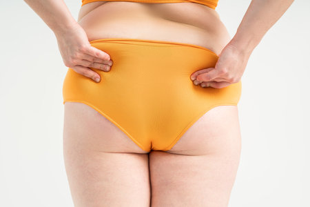 Overweight thigh, woman with fat hips and buttocks, obesity female body with cellulite on gray studio backgroundの写真素材