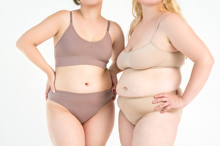 Two overweight women with cellulitis, fat flabby bellies, legs, hands, hips and buttocks on gray studio background, obese female body, liposuction and plastic surgery conceptの写真素材