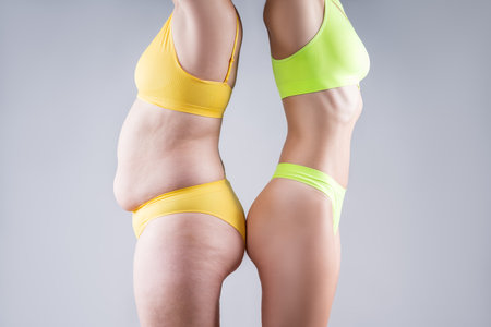 Before after weight loss, tummy tuck, fat and thin women with flabby and muscular bellies on gray studio background, plastic surgery and body positive conceptの写真素材
