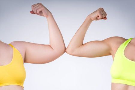 Before after weight loss, hand liposuction, two women with fat and thin hands, obesity and muscular...