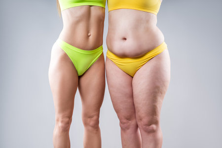 Before after weight loss, tummy tuck, fat and thin women with flabby and muscular bellies on gray studio background, plastic surgery and body positive conceptの写真素材