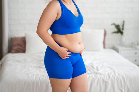 Tummy tuck, flabby skin on a fat belly, plastic surgery and liposuction concept at homeの写真素材