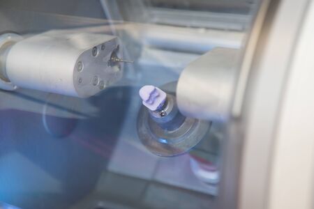 finished dental implant in the CEREC dental milling machine in the doctor's officeの写真素材