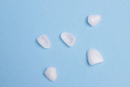 five dental veneers lie on a tableの写真素材